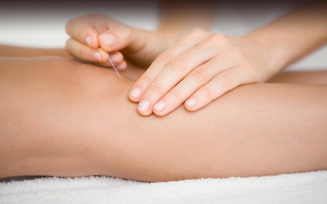 5 Common Side Effects Of Acupuncture